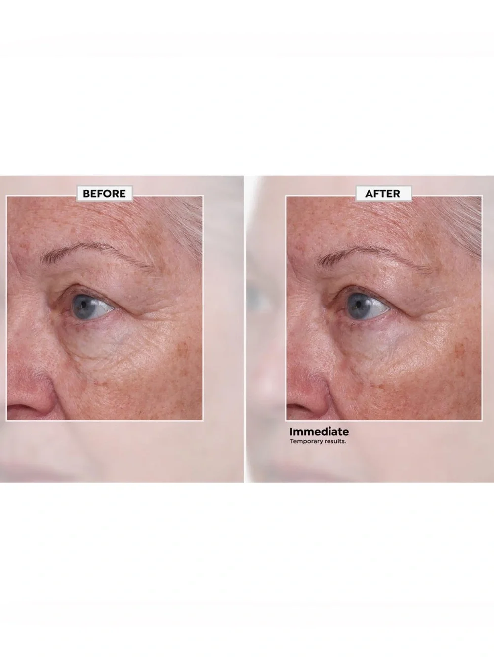 Nakery Beauty SkinRepair Retinol Deep Wrinkle Serum- firming, lifting, smoothing